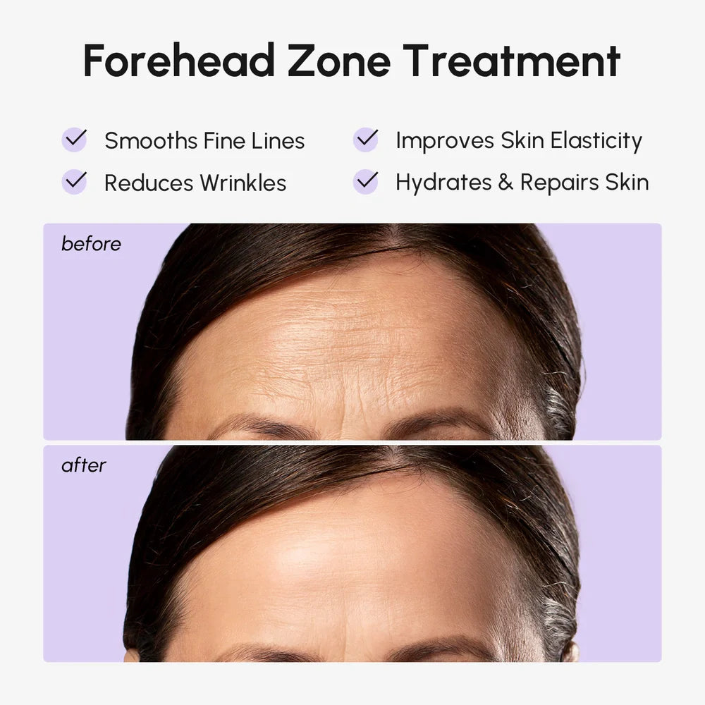 Anti-Wrinkle Forehead Patches for smoothing fine lines